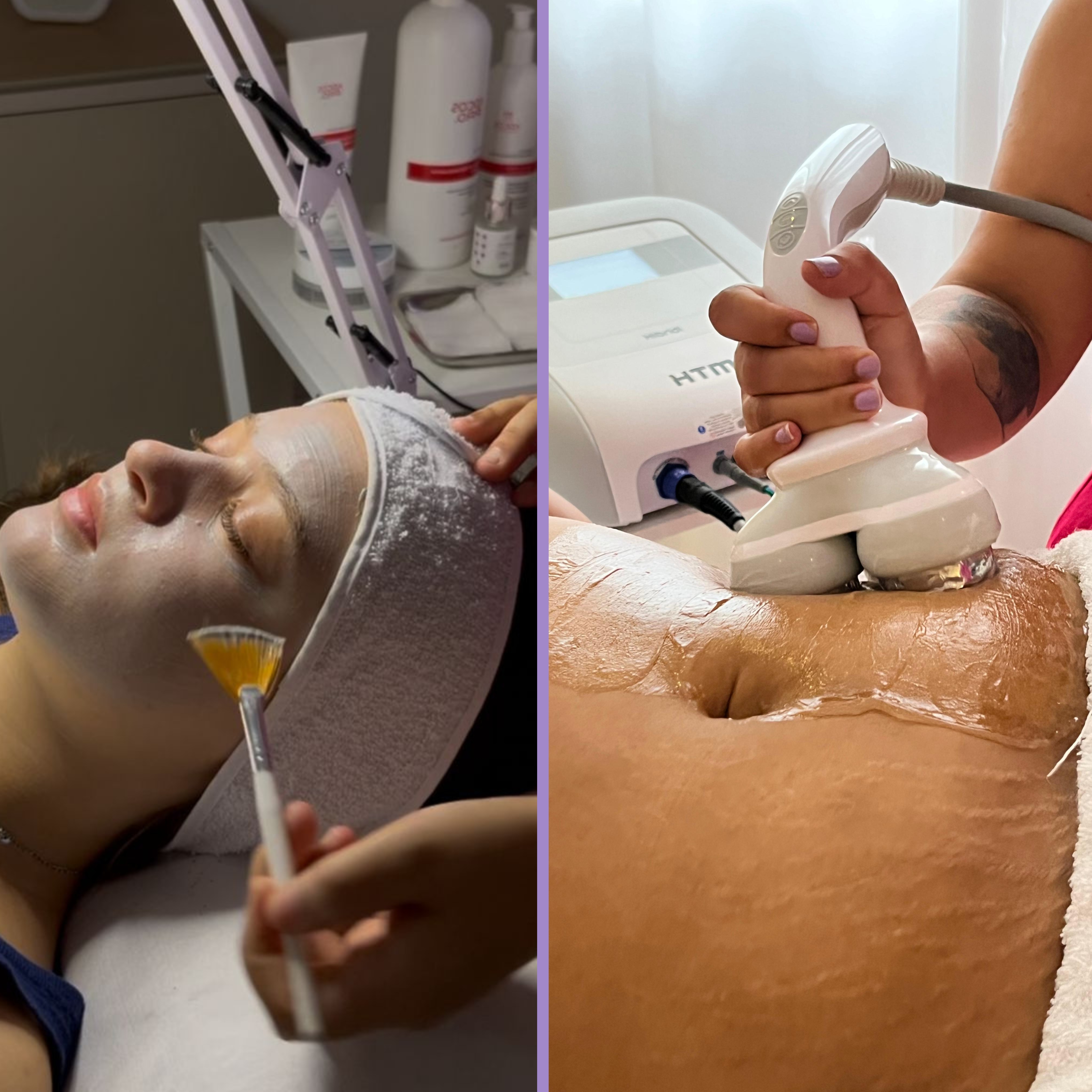 Estética facial e corporal em Sorocaba