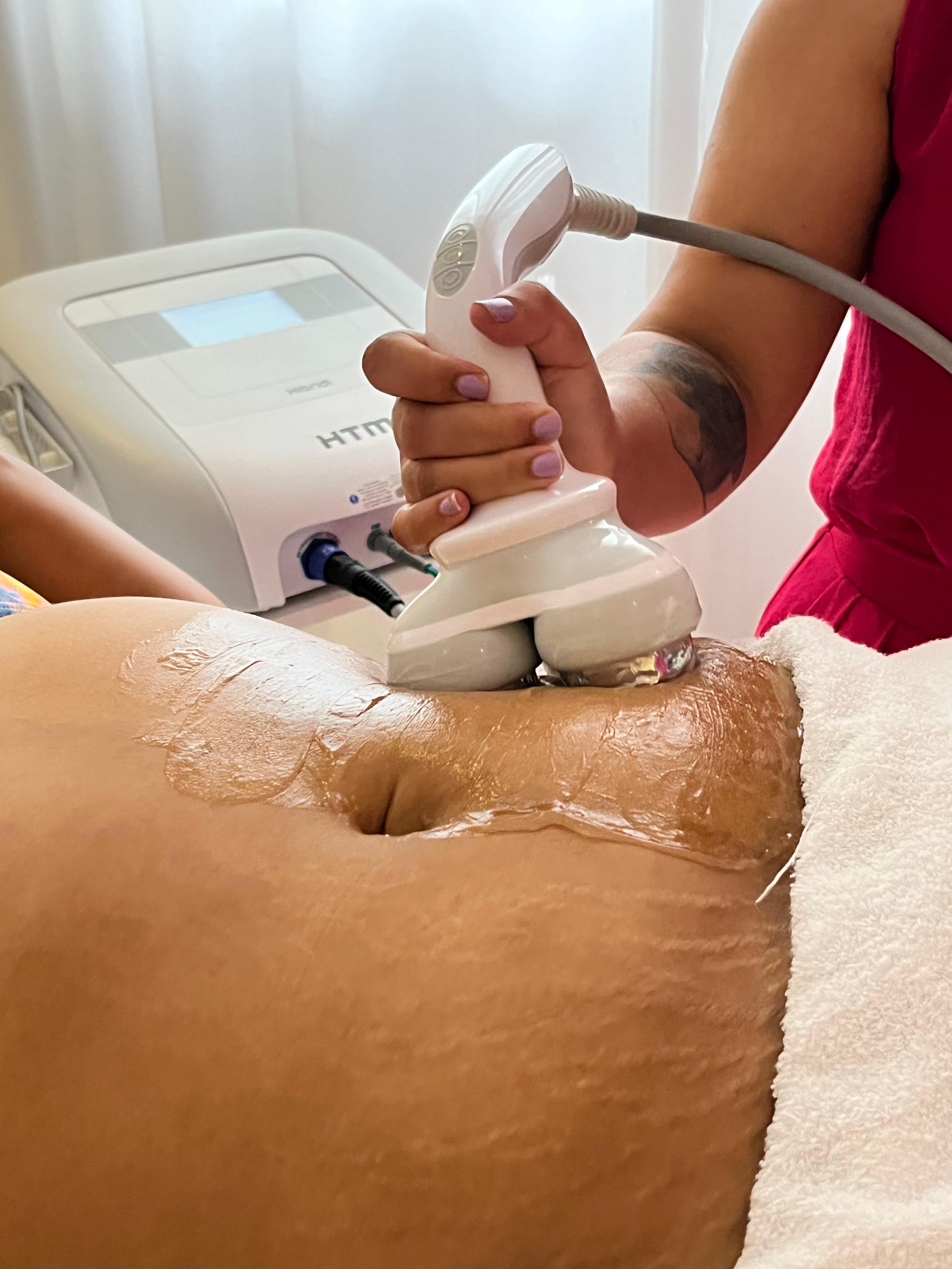 Estética corporal e drenagem linfática em Sorocaba